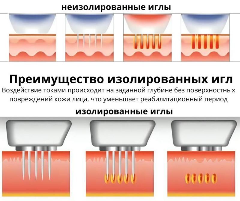 Фракционный микроигольчатый RF